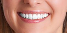 What Are the Advantages of Dental Implants